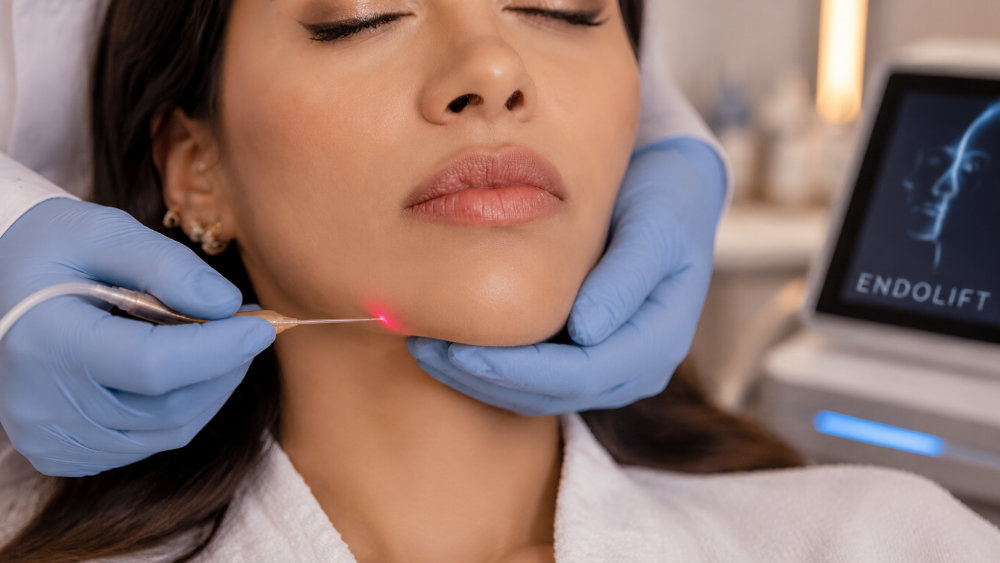 Endolift